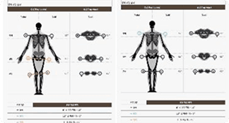 큐티****님의 아이밸런스 리뷰 이미지