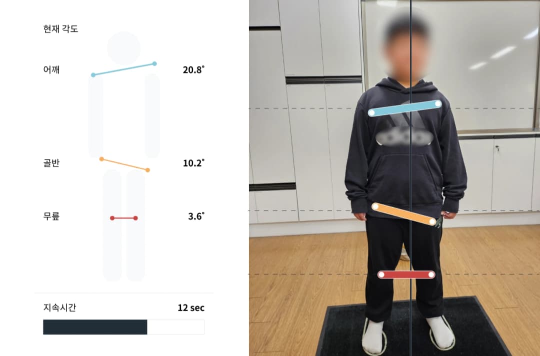 POMS 정면 측정 예시