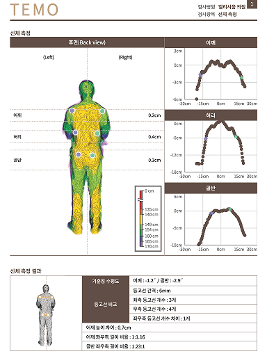 경근무늬측정검사 리포트 이미지